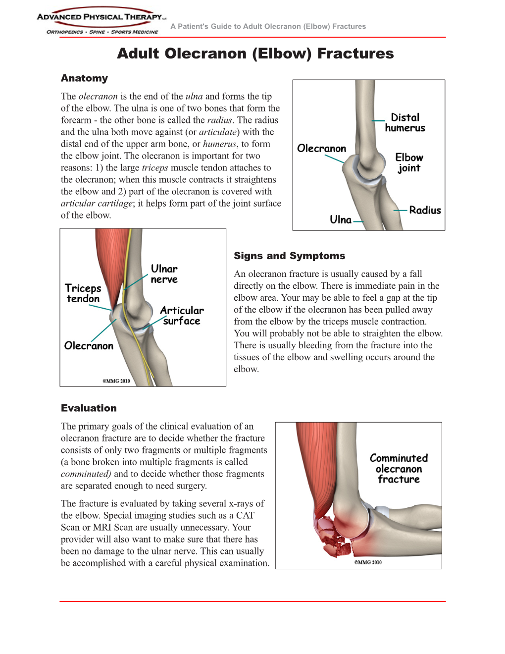 (Elbow) Fractures