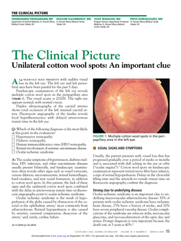 Unilateral Cotton Wool Spots: an Important Clue