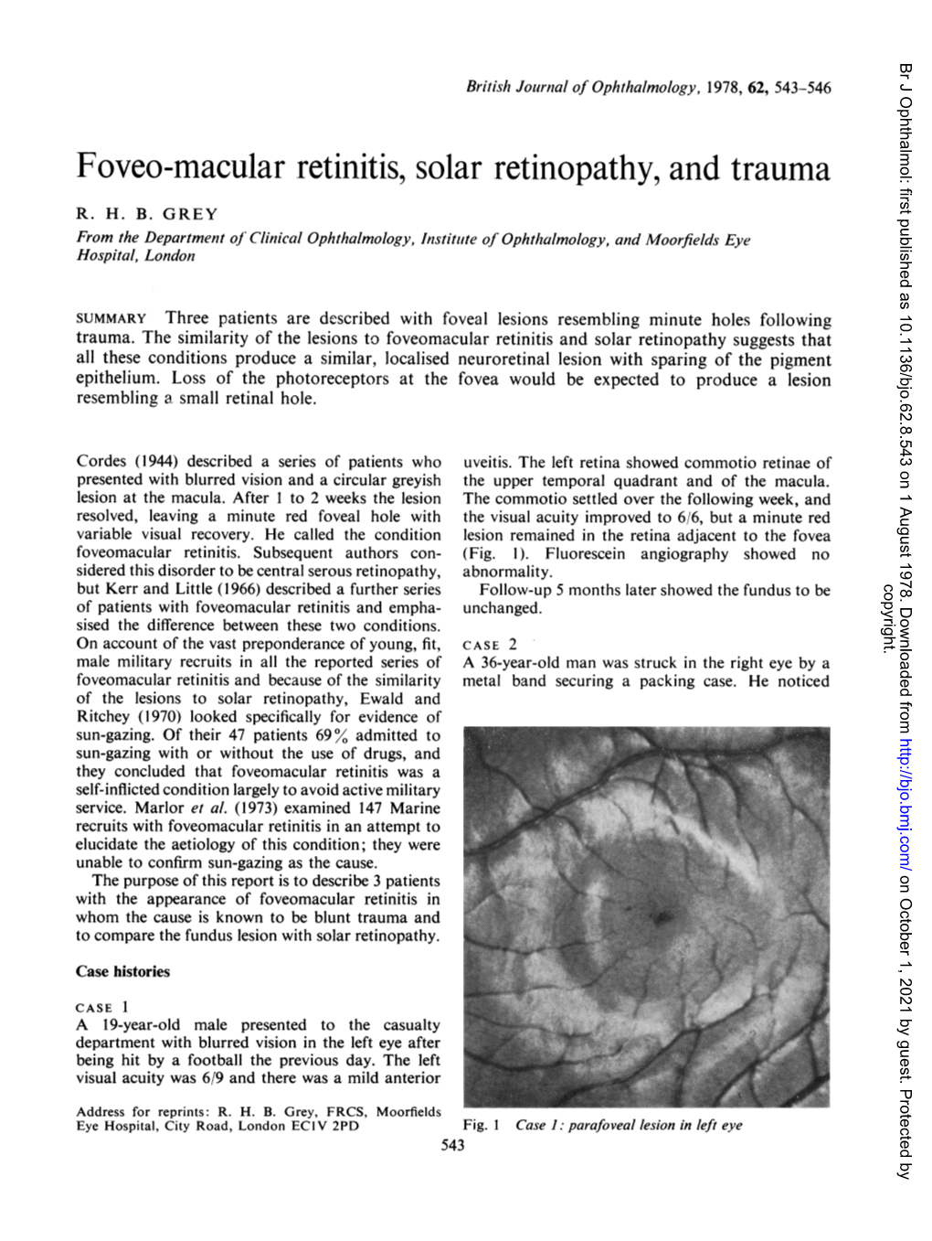 Foveo-Macular Retinitis,Solar Retinopathy, and Trauma