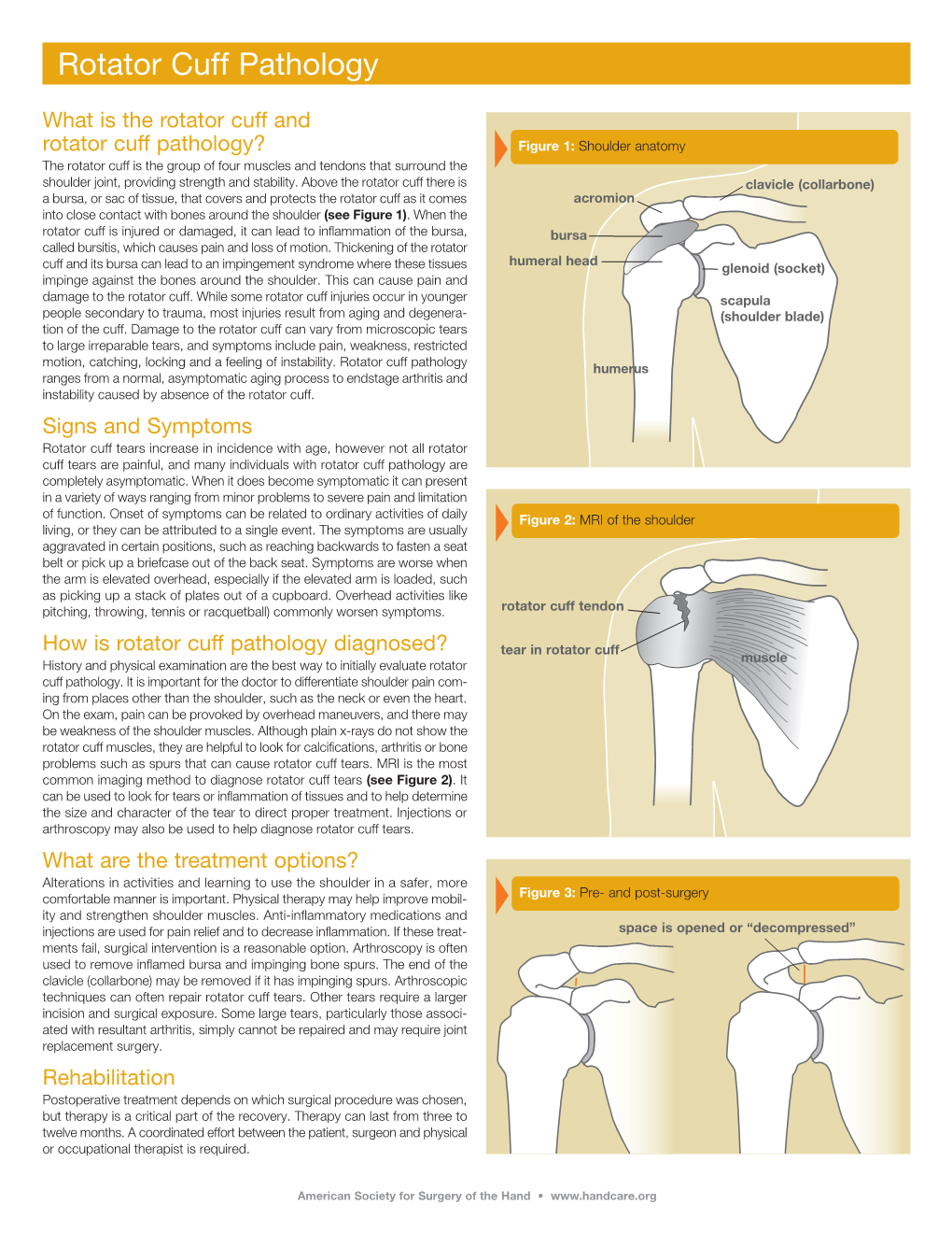 Rotator Cuff Pathology