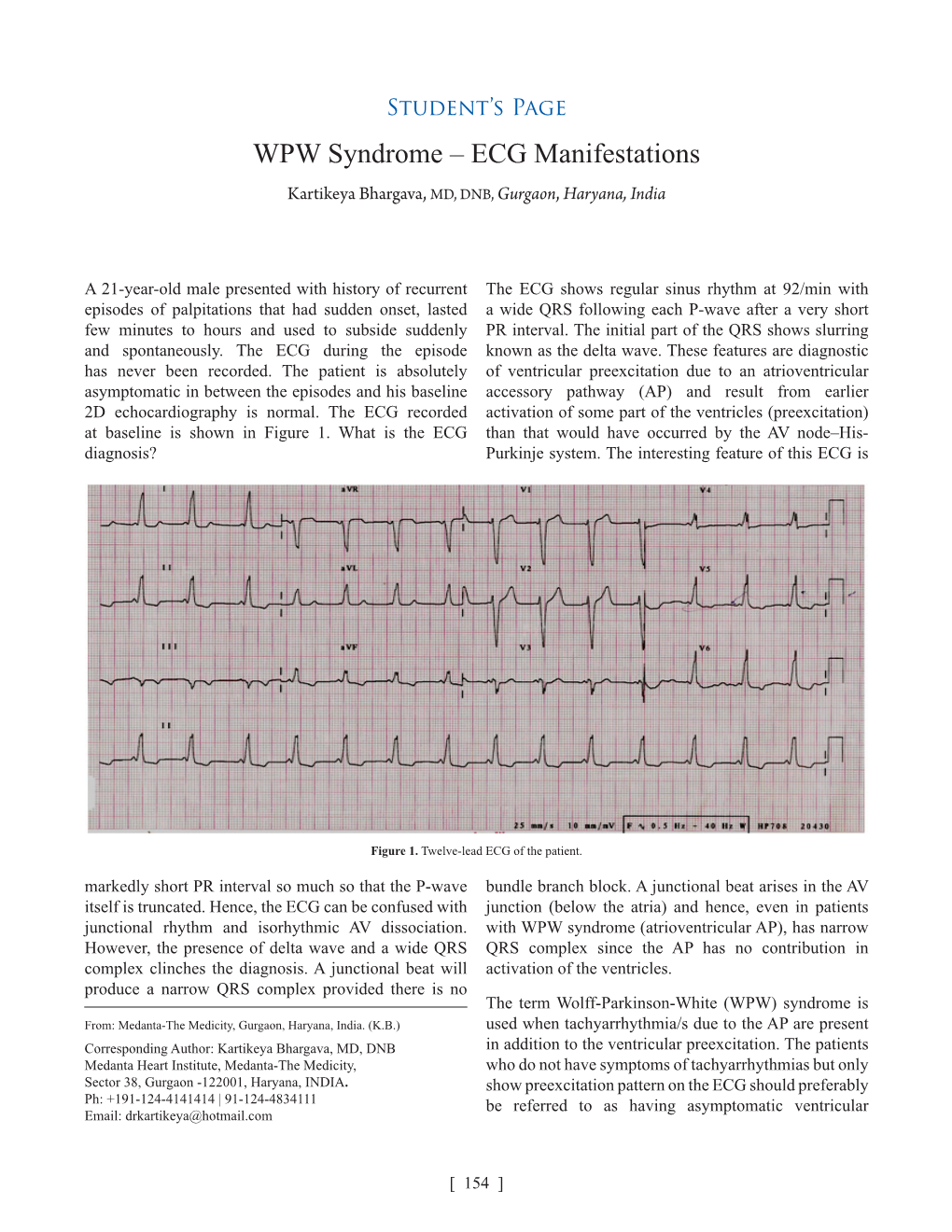 WPW Syndrome – ECG Manifestations