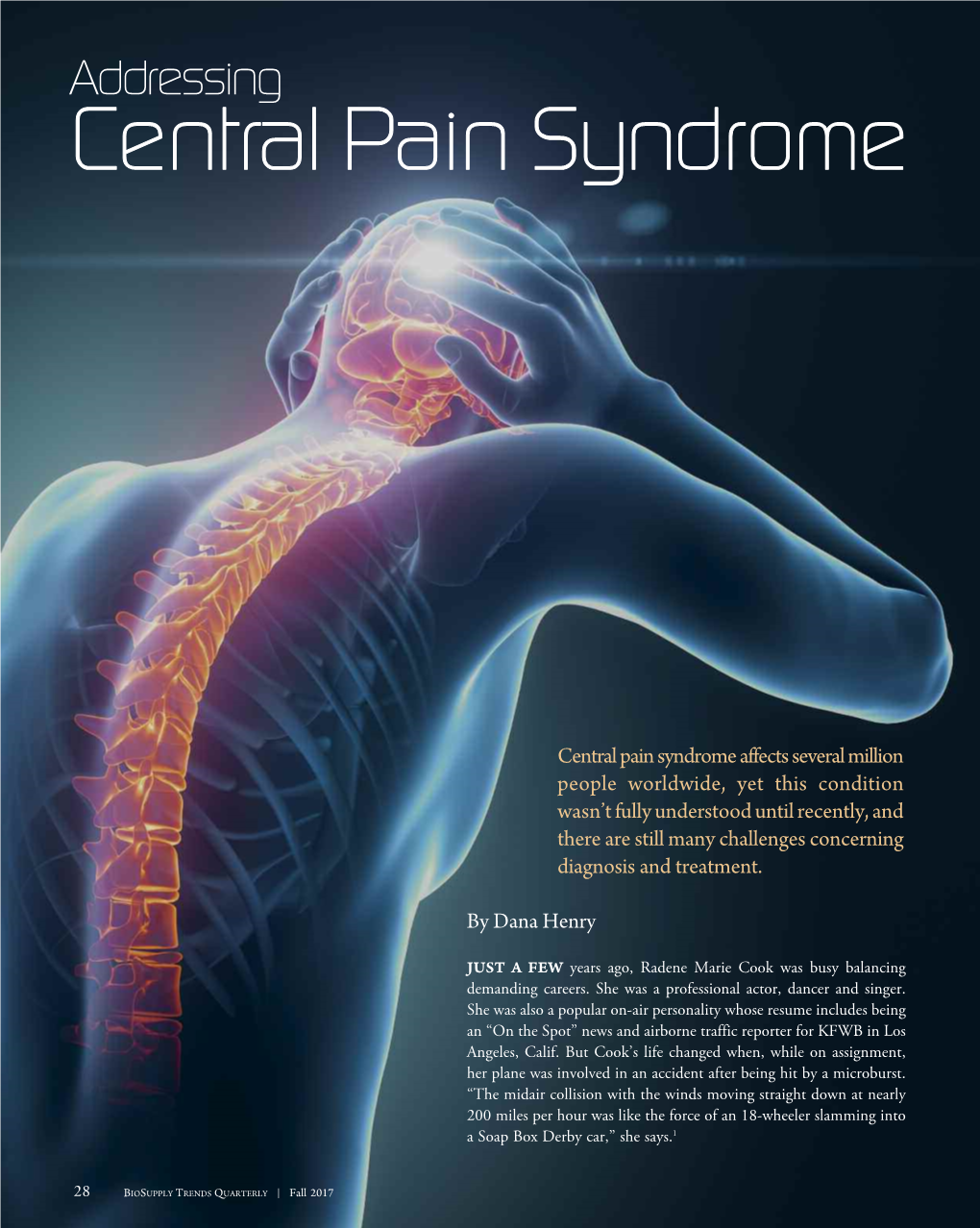 Addressing Central Pain Syndrome