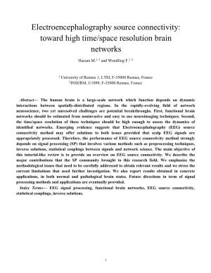 Electroencephalography Source Connectivity: Toward High Time/Space Resolution Brain Networks