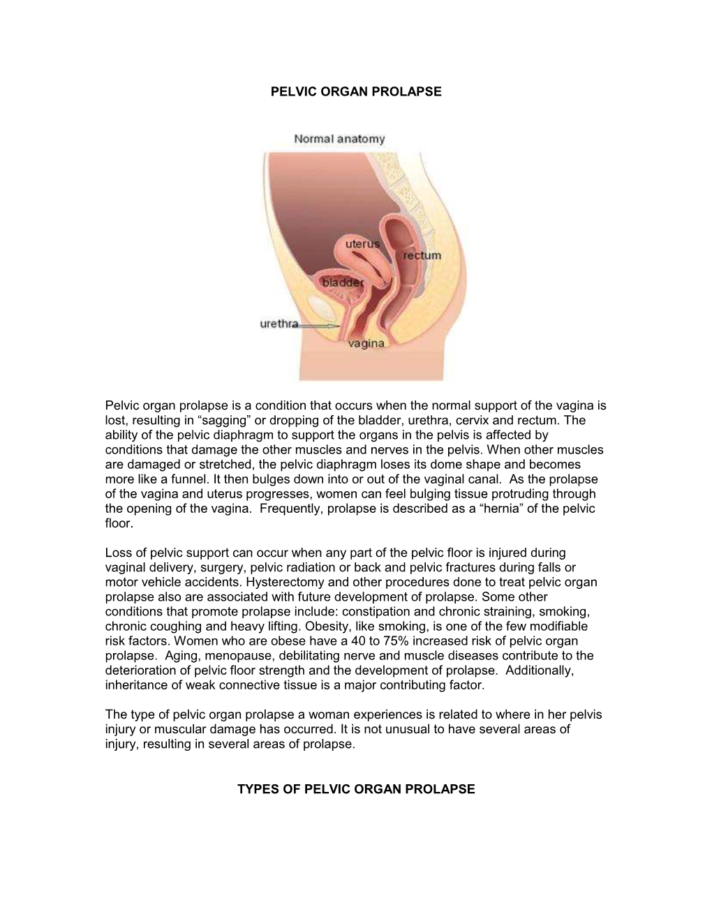 Pelvic Organ Prolapse