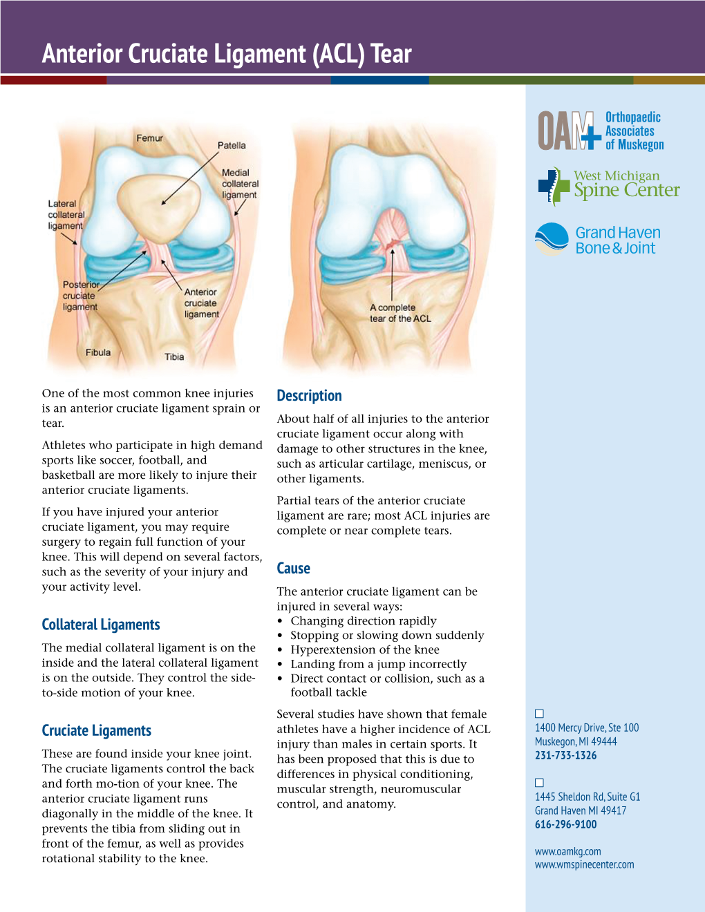 Anterior Cruciate Ligament (ACL) Tear