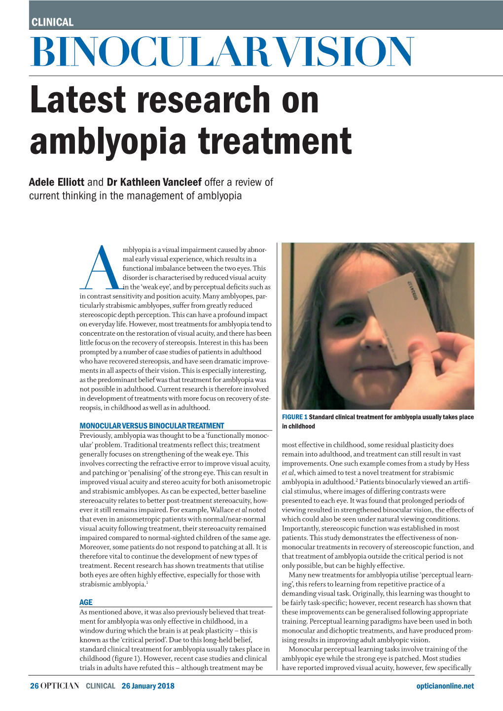 Latest Research on Amblyopia Treatment