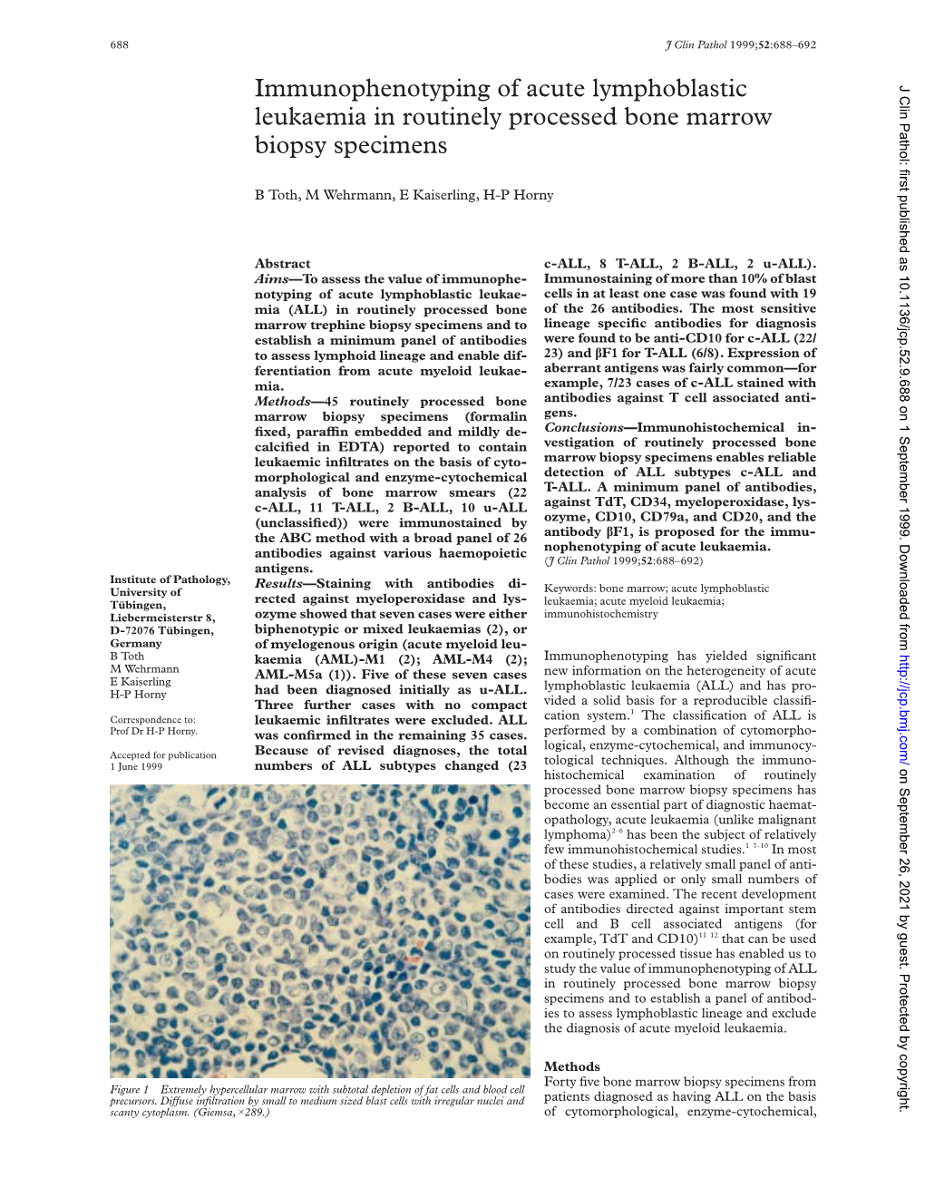 Immunophenotyping of Acute Lymphoblastic Leukaemia In