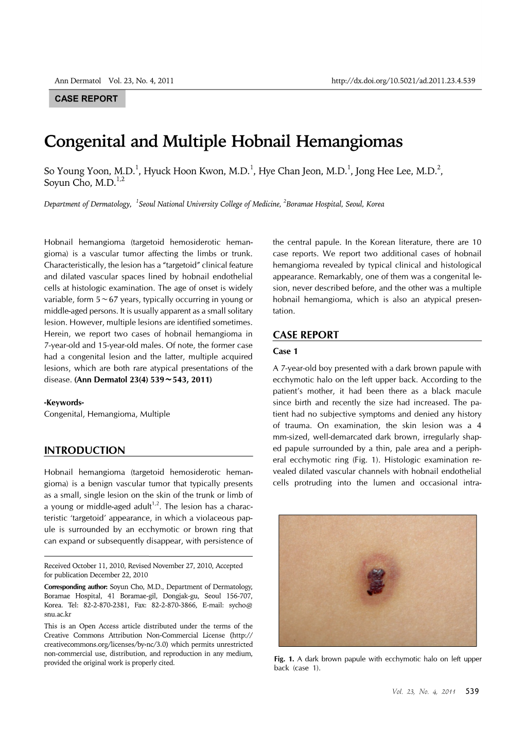 Congenital and Multiple Hobnail Hemangiomas Ann Dermatol Vol