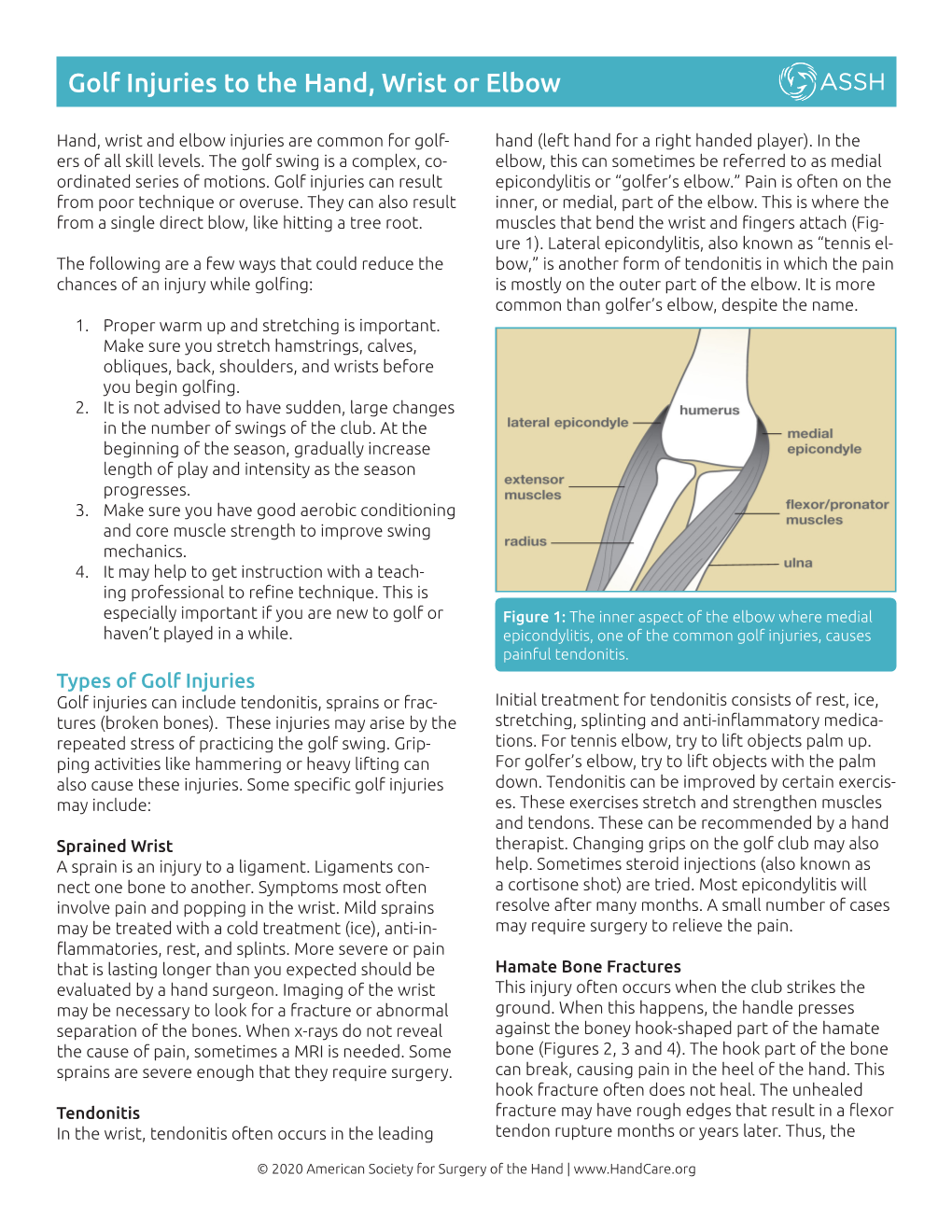 Golf Injuries to the Hand, Wrist Or Elbow