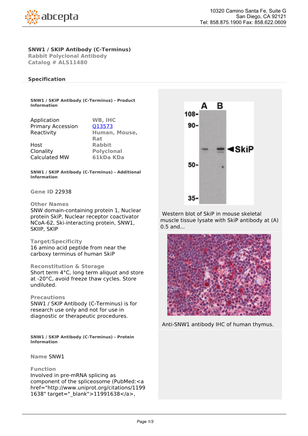 SNW1 / SKIP Antibody (C-Terminus) Rabbit Polyclonal Antibody Catalog # ALS11480