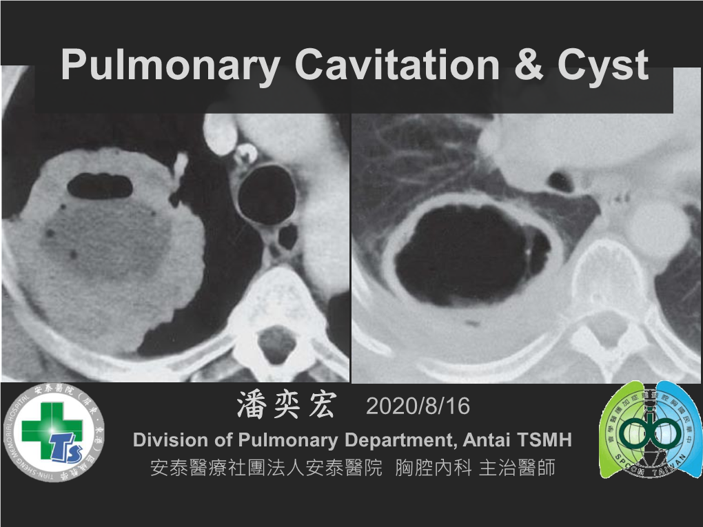 Pulmonary Cavitation & Cyst