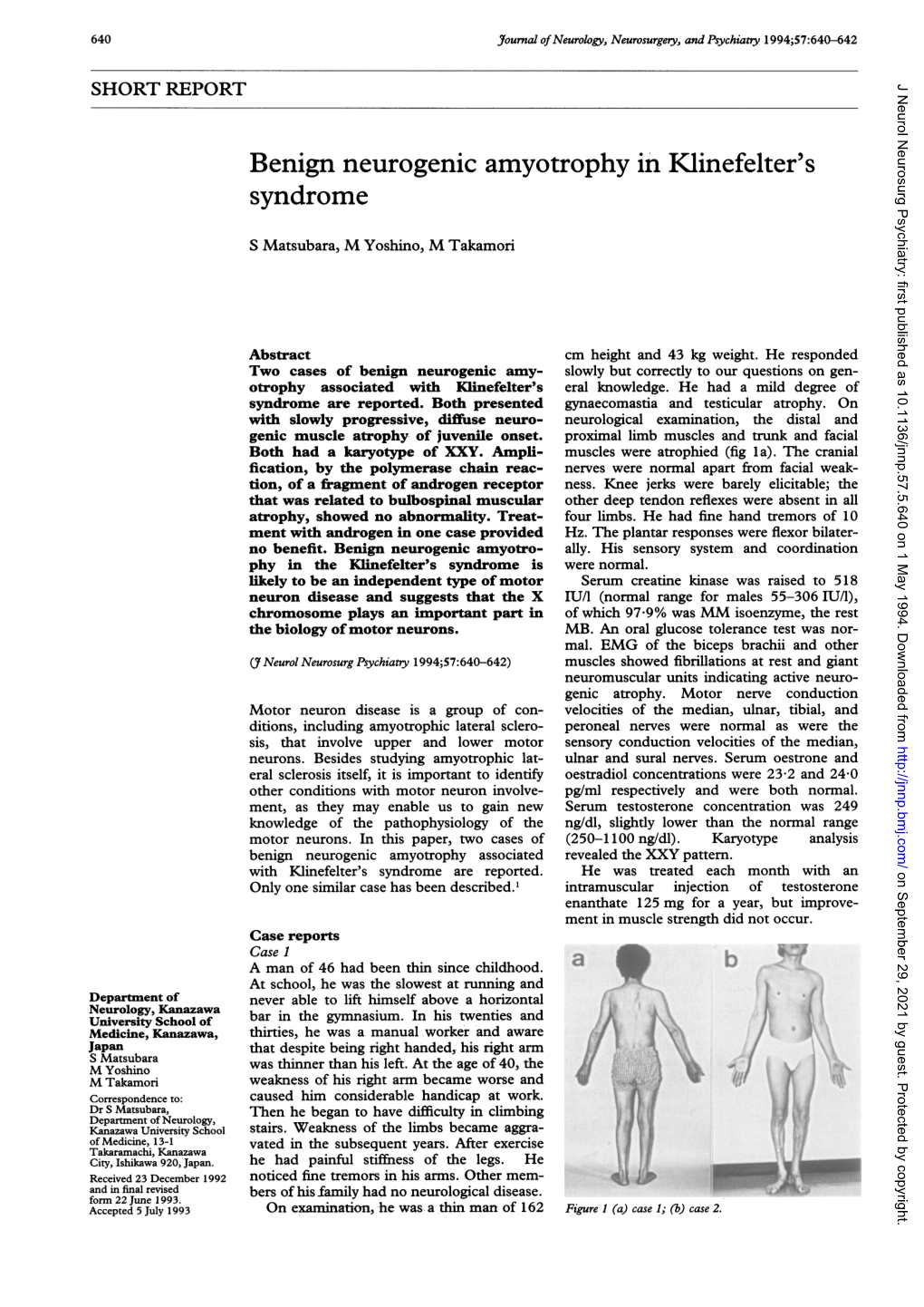 Benign Neurogenic Amyotrophy in Klinefelter's Syndrome