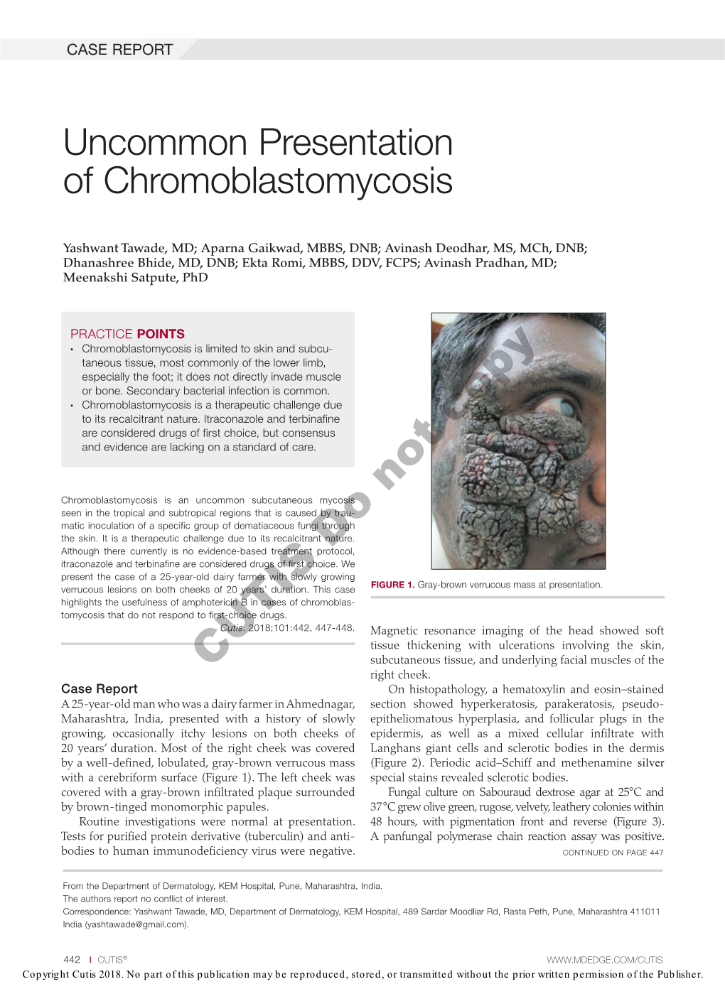 Uncommon Presentation of Chromoblastomycosis