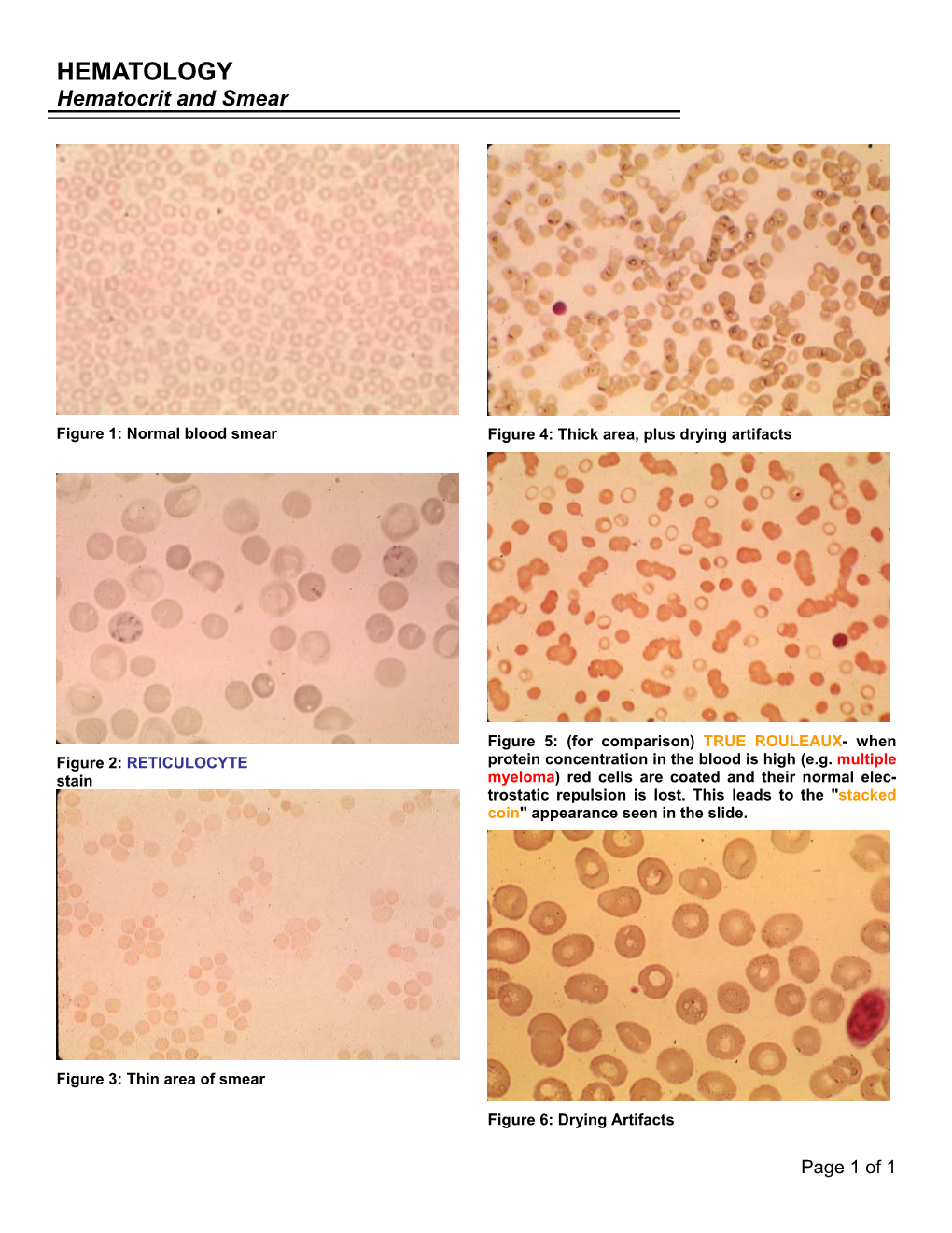 HEMATOLOGY Hematocrit and Smear