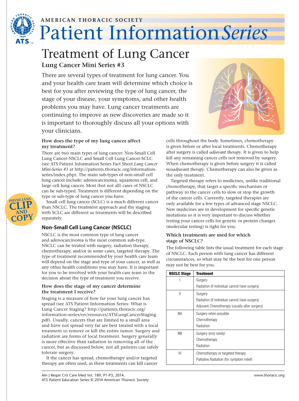 Treatment of Lung Cancer Lung Cancer Mini Series #3 There Are Several Types of Treatment for Lung Cancer