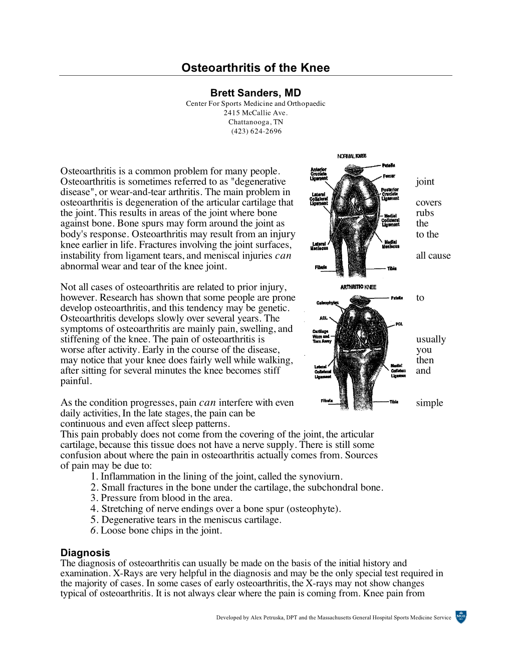 Osteoarthritis of the Knee