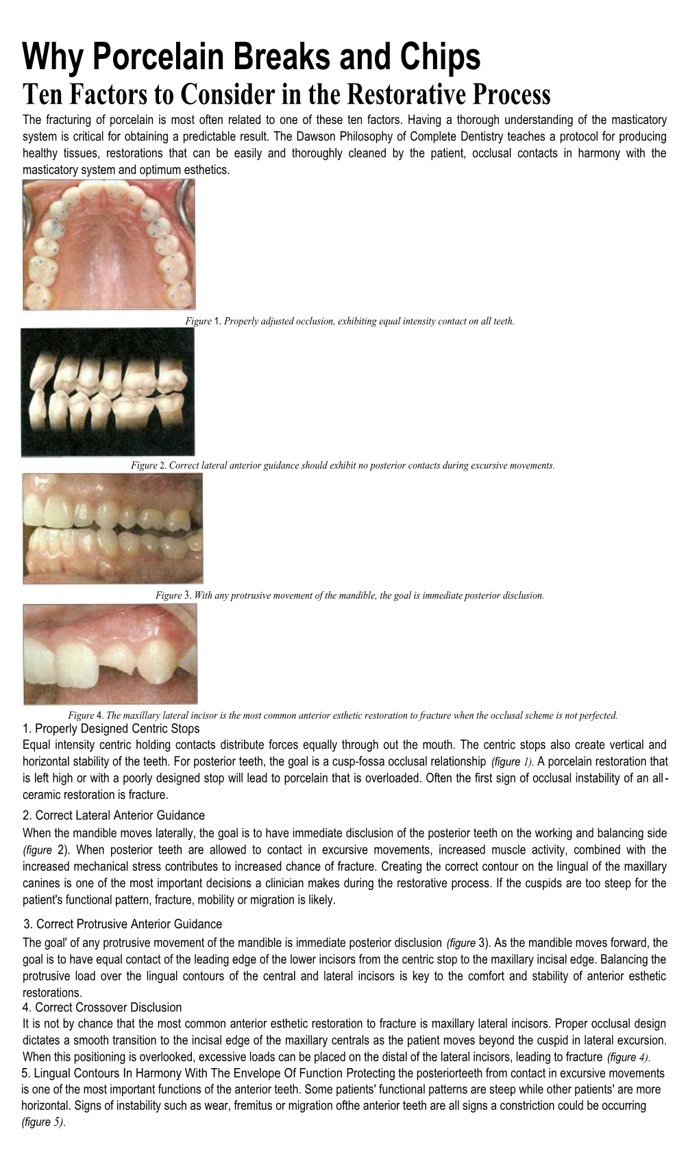 Why Porcelain Breaks and Chips