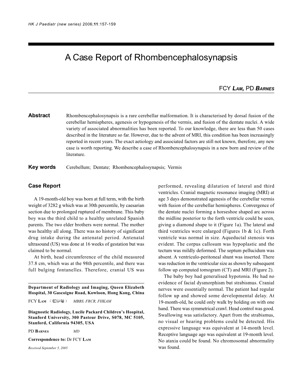A Case Report of Rhombencephalosynapsis