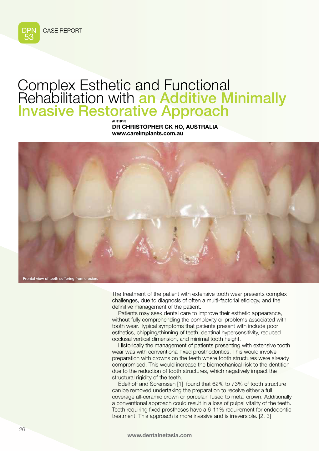 Complex Esthetic a Rehabilitation with P an Additive