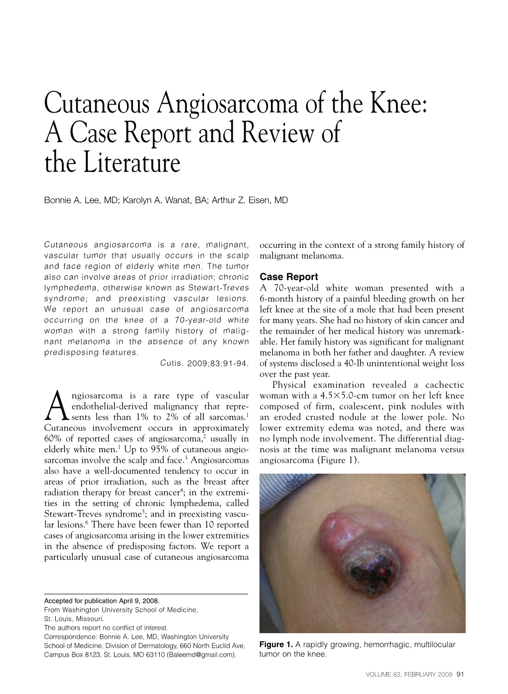 Cutaneous Angiosarcoma of the Knee: a Case Report and Review of the Literature