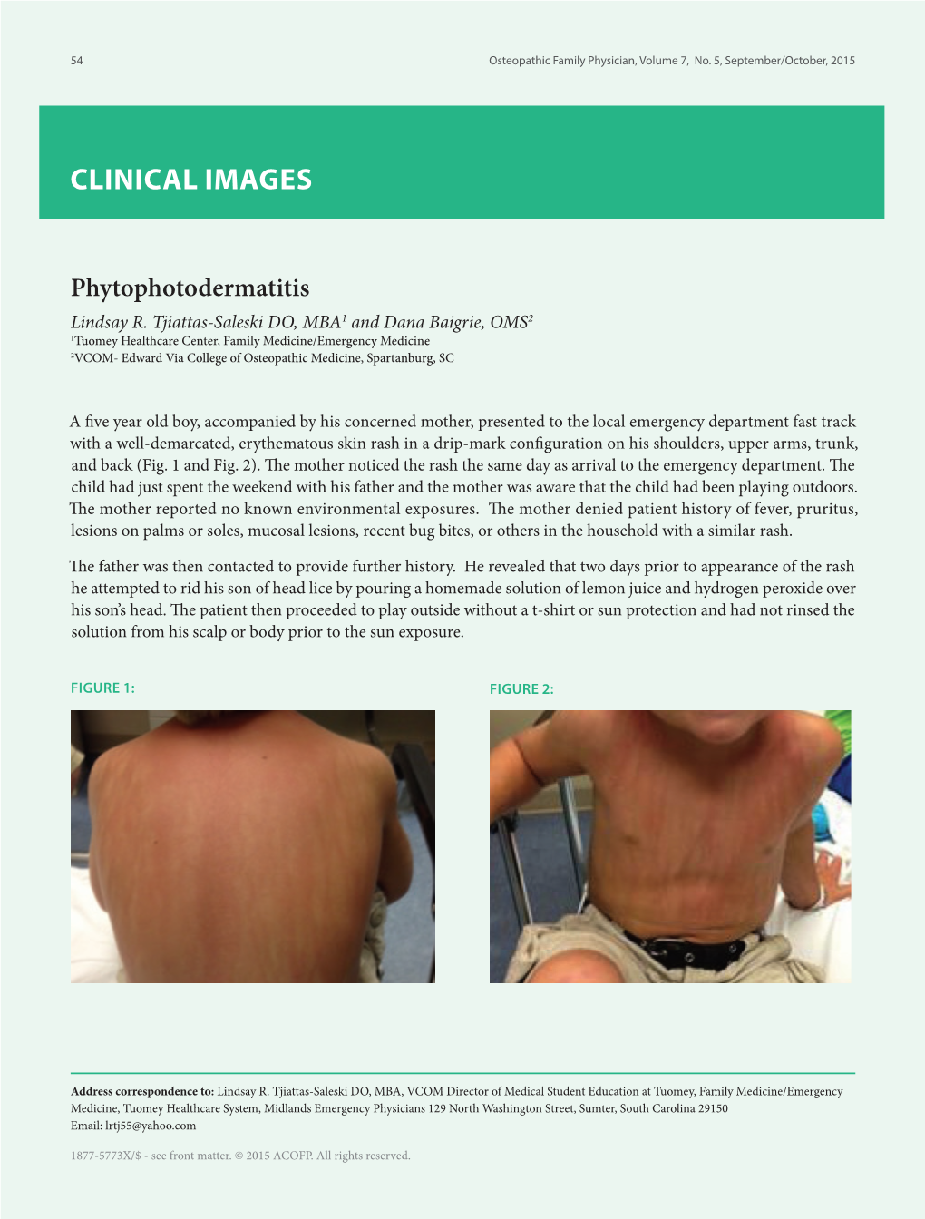 Phytophotodermatitis Lindsay R