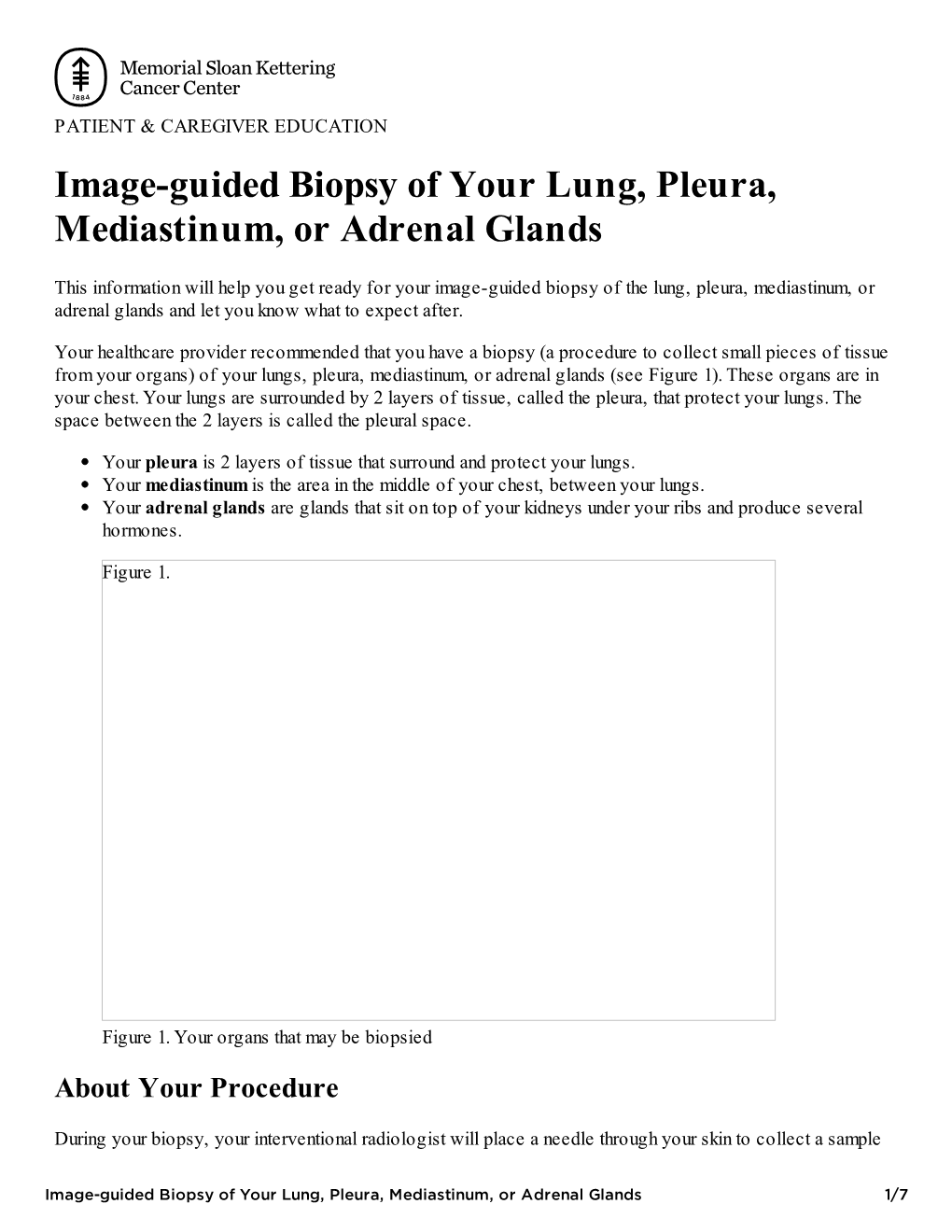 Image-Guided Biopsy of Your Lung, Pleura, Mediastinum, Or Adrenal Glands