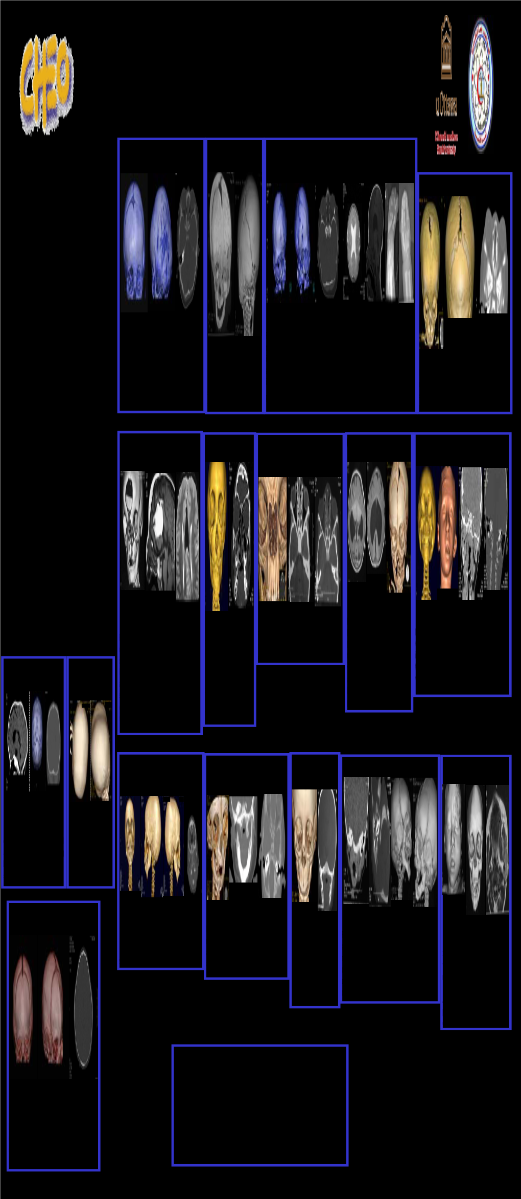 Congenital Craniofacial Deformities: Spectrum of Multidetector Computed Tomographic Findings