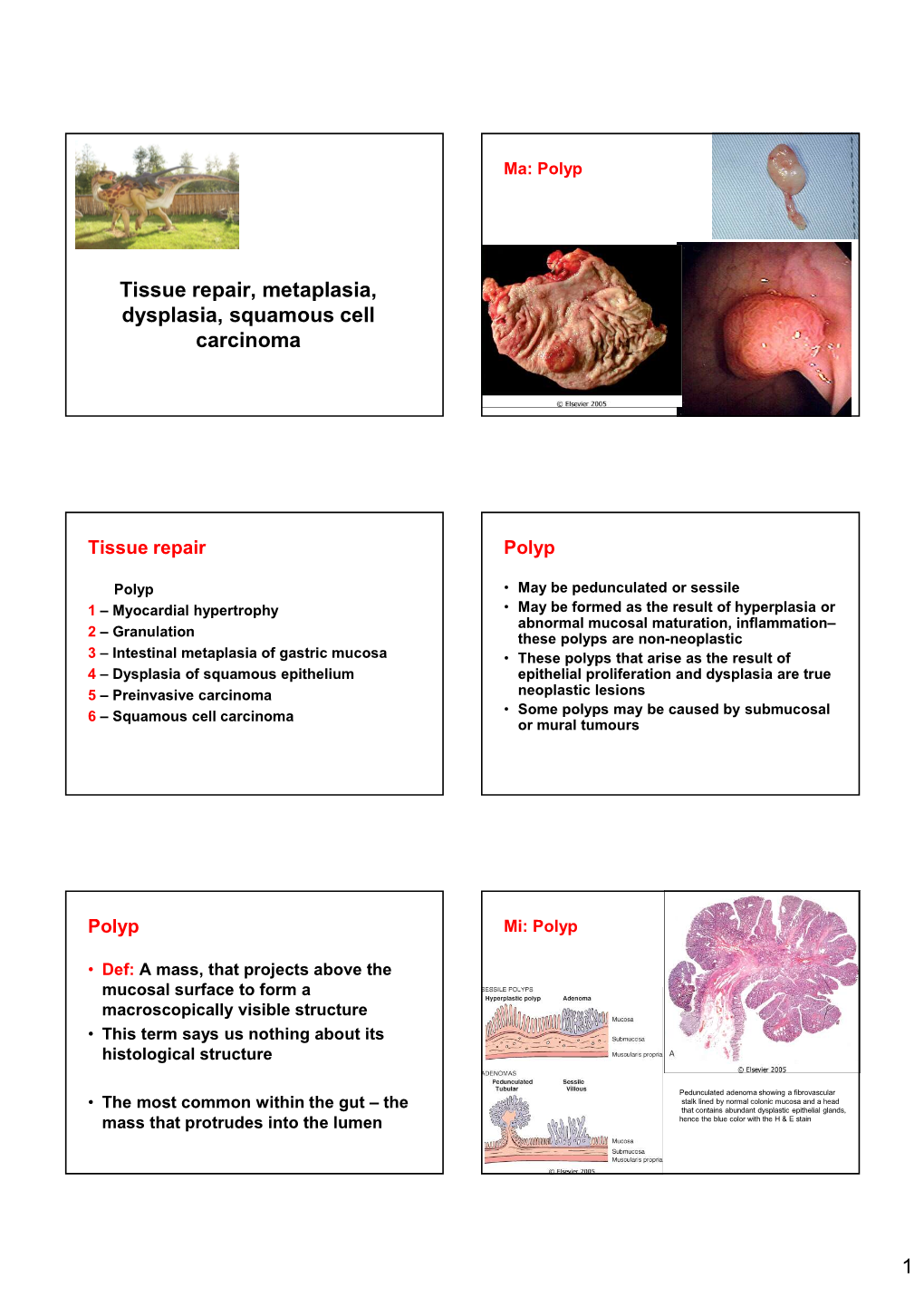 Tissue Repair, Metaplasia, Dysplasia, Squamous Cell Carcinoma