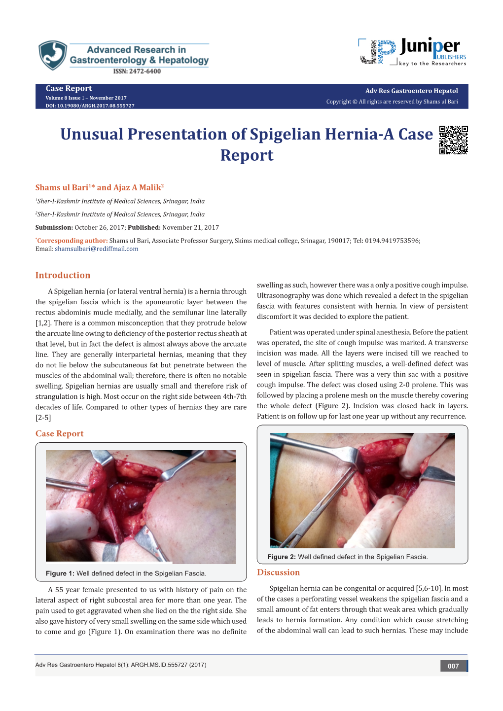 Unusual Presentation of Spigelian Hernia-A Case Report