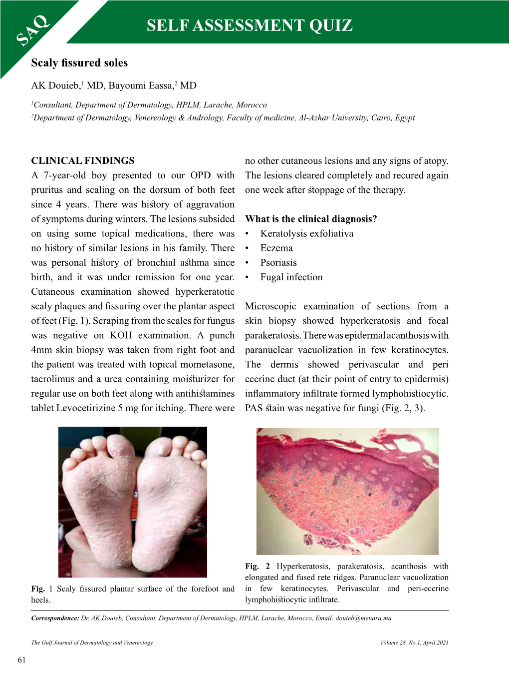 SELF ASSESSMENT QUIZ SAQ Scaly Fissured Soles