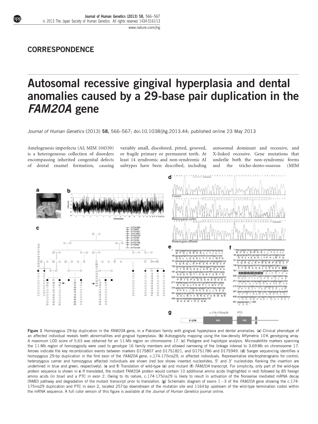 Autosomal Recessive Gingival Hyperplasia and Dental Anomalies Caused by a 29-Base Pair Duplication in the FAM20A Gene