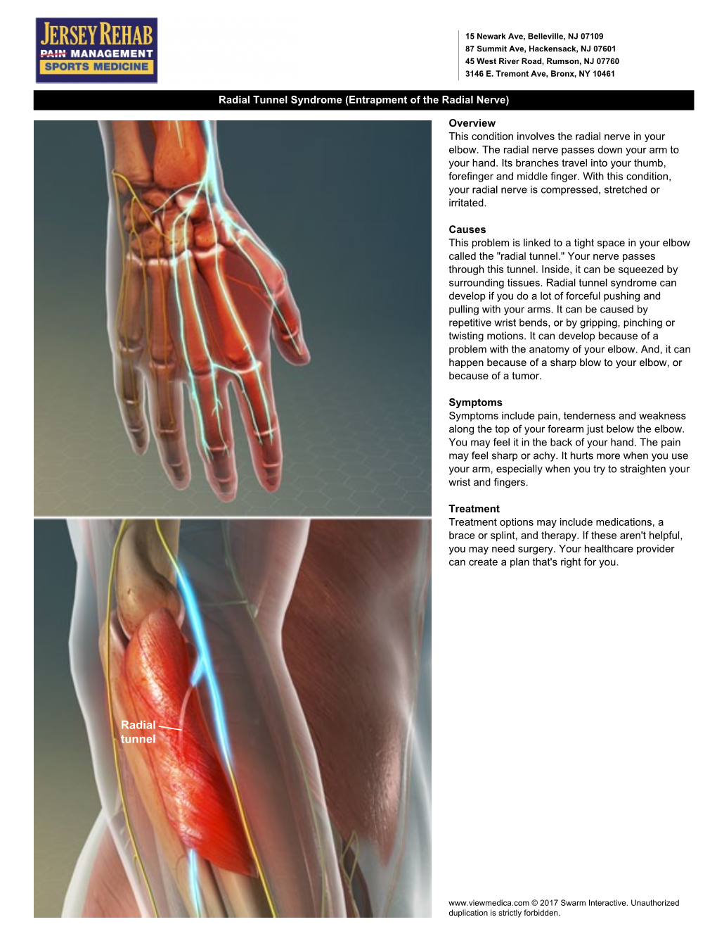 Radial Tunnel Syndrome (Entrapment of the Radial Nerve)