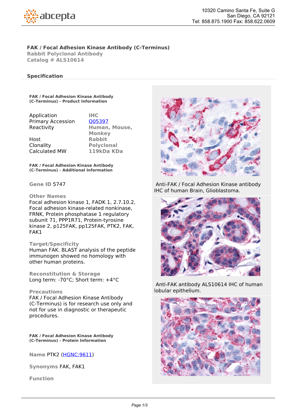 FAK / Focal Adhesion Kinase Antibody (C-Terminus) Rabbit Polyclonal Antibody Catalog # ALS10614