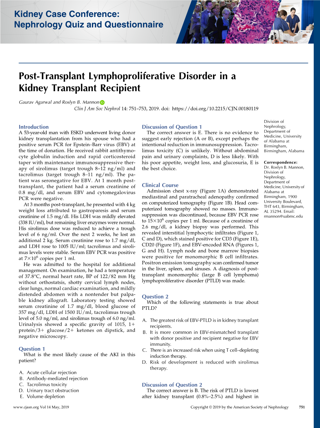 Post-Transplant Lymphoproliferative Disorder in a Kidney Transplant Recipient