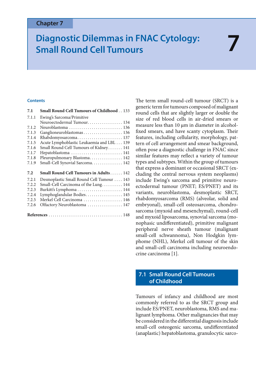 Diagnostic Dilemmas in FNAC Cytology: Small Round Cell Tumours 7