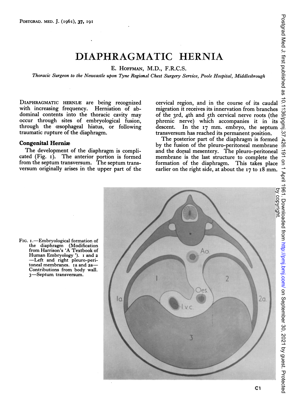 Diaphragmatic Hernia E