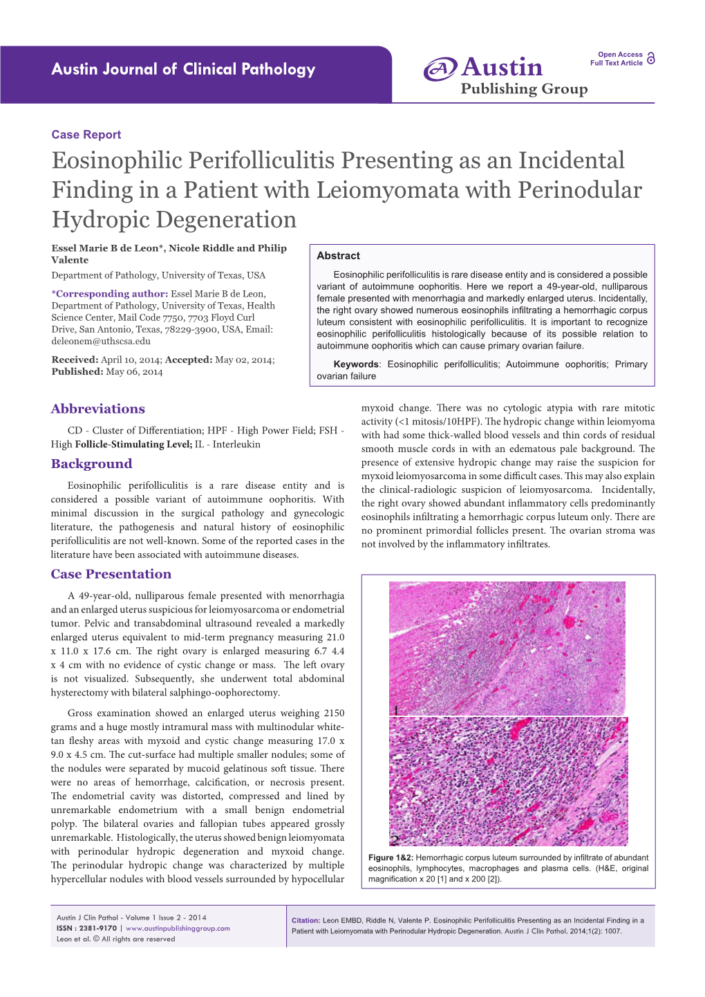 Eosinophilic Perifolliculitis Presenting As an Incidental Finding in a Patient with Leiomyomata with Perinodular Hydropic Degeneration