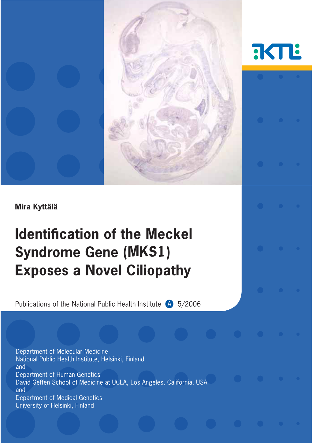 Identiffcation of the Meckel Syndrome Gene (MKS1)