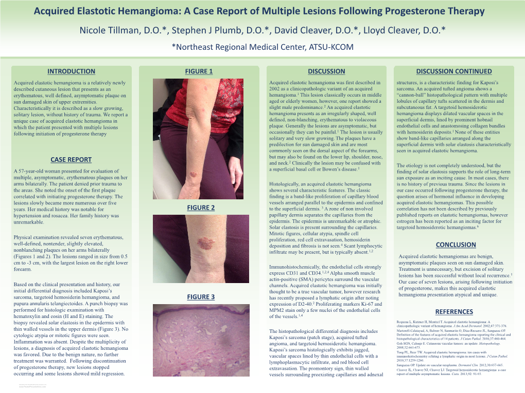 Acquired Elastotic Hemangioma