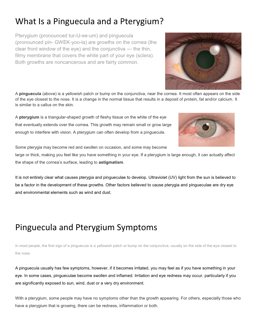 Pinguecula and Pterygium Symptoms