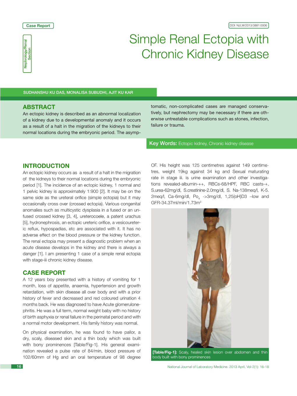 Simple Renal Ectopia with Chronic Kidney Disease