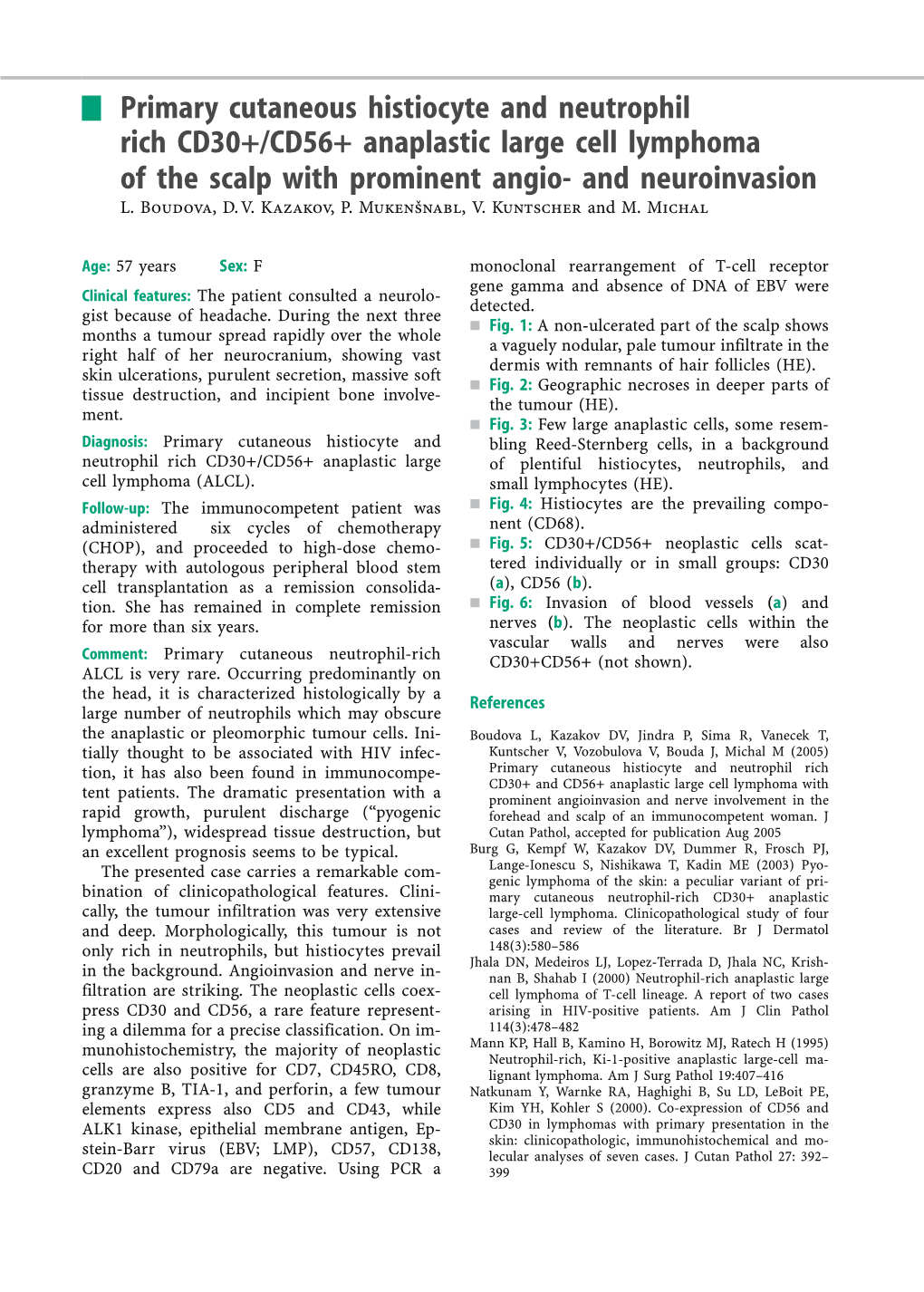 Primary Cutaneous Histiocyte and Neutrophil Rich CD30+/CD56+ Anaplastic Large Cell Lymphoma of the Scalp with Prominent Angio- and Neuroinvasion L