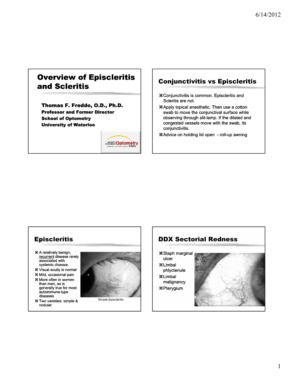 Overview of Overview of Episcleritis Episcleritis and Scleritis Scleritis