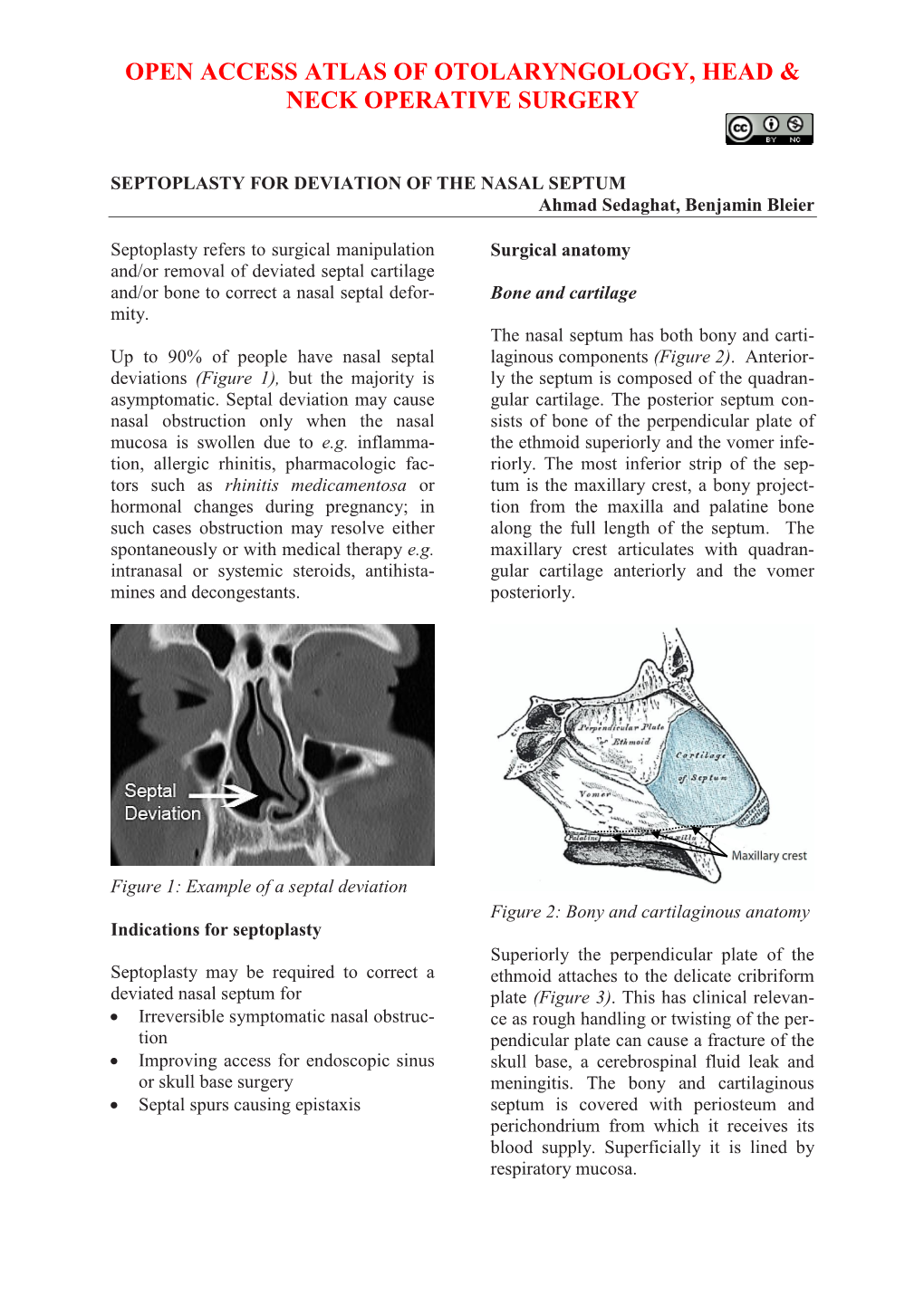 Open Access Atlas of Otolaryngology, Head & Neck Operative Surgery