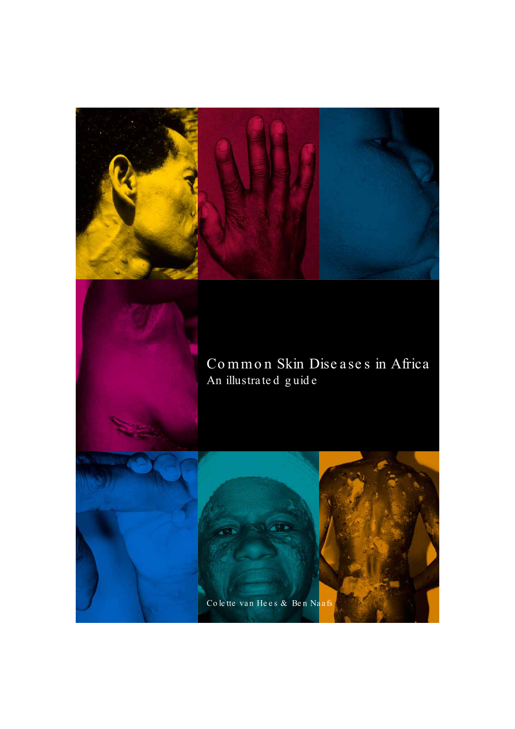 Common Skin Diseases in Africa an Illustrated Guide