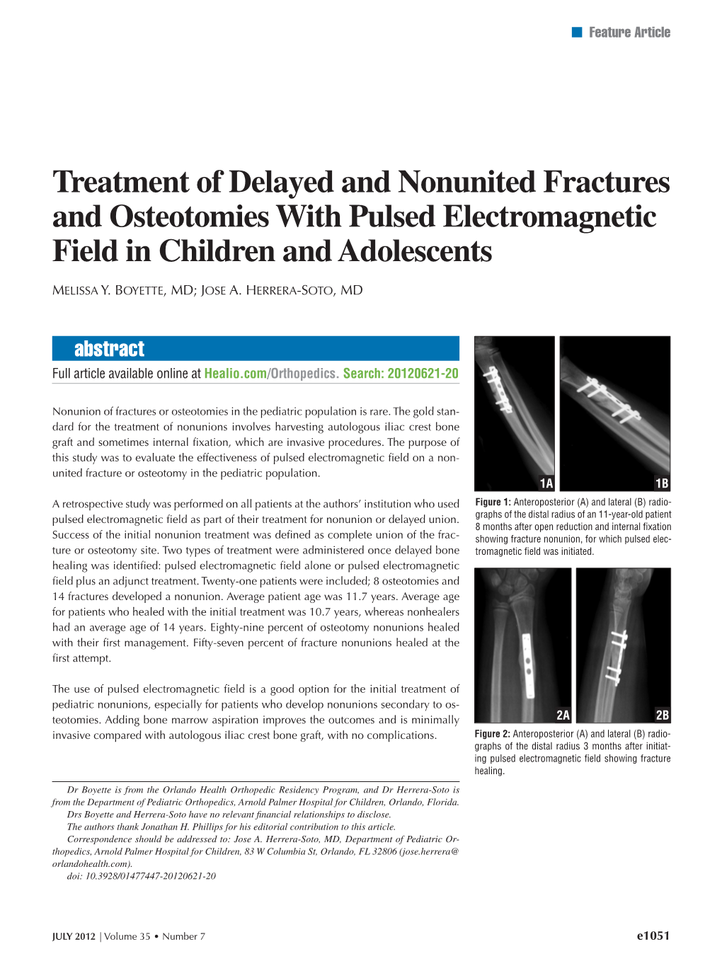 Treatment of Delayed and Nonunited Fractures and Osteotomies with Pulsed Electromagnetic Field in Children and Adolescents