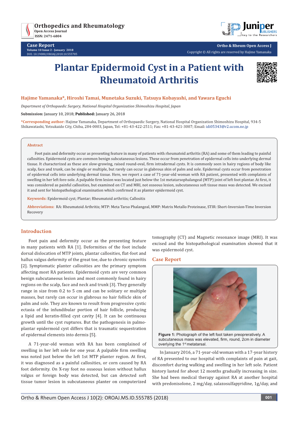 Plantar Epidermoid Cyst in a Patient with Rheumatoid Arthritis