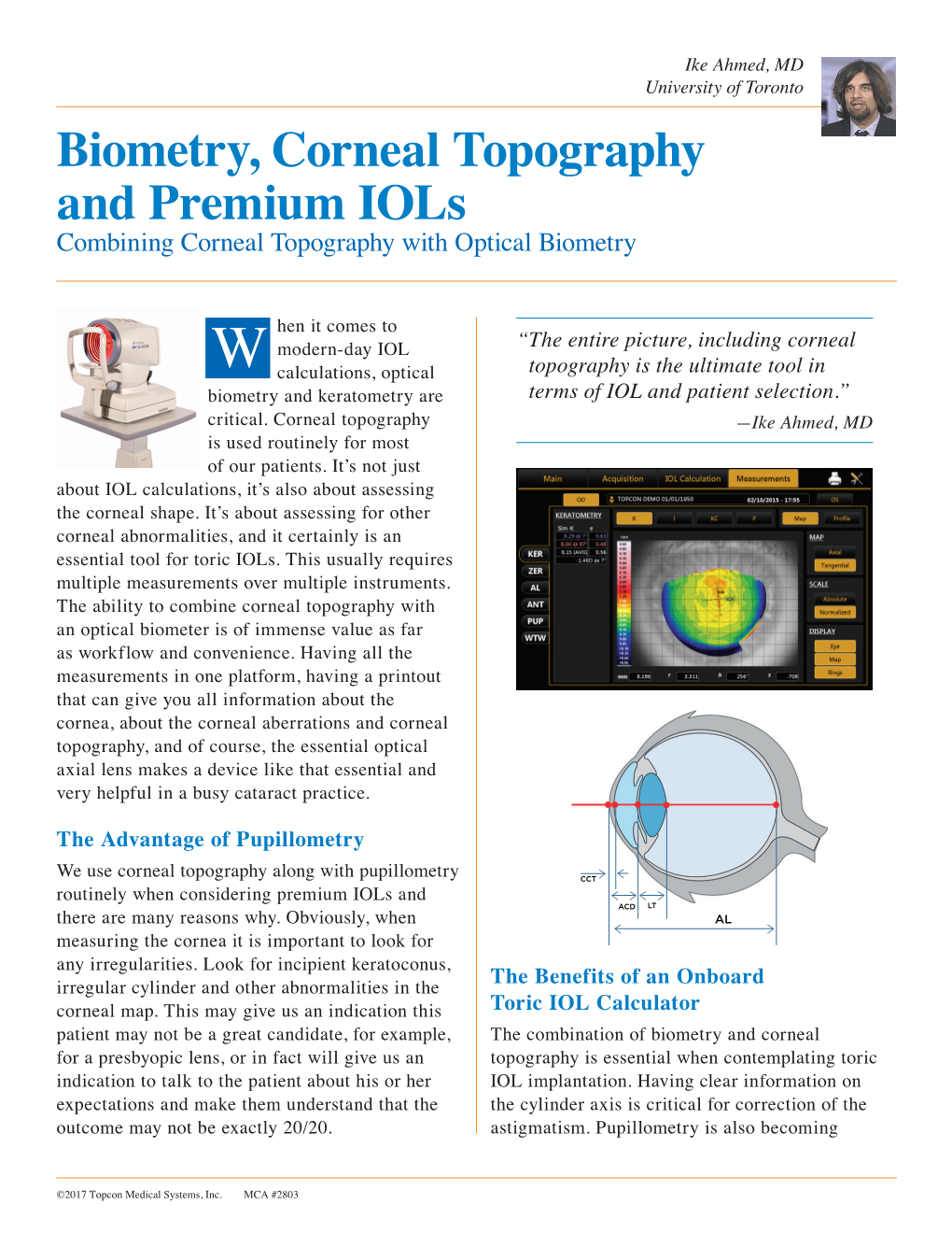 Biometry, Corneal Topography and Premium Iols Combining Corneal Topography with Optical Biometry