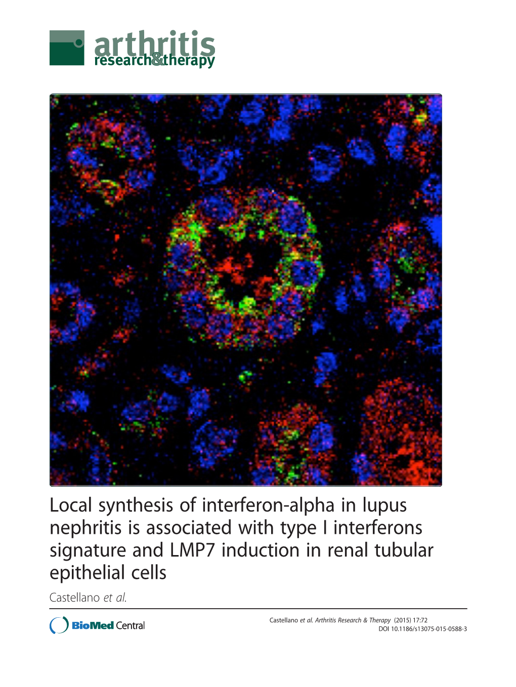 Local Synthesis of Interferon-Alpha in Lupus Nephritis Is Associated With