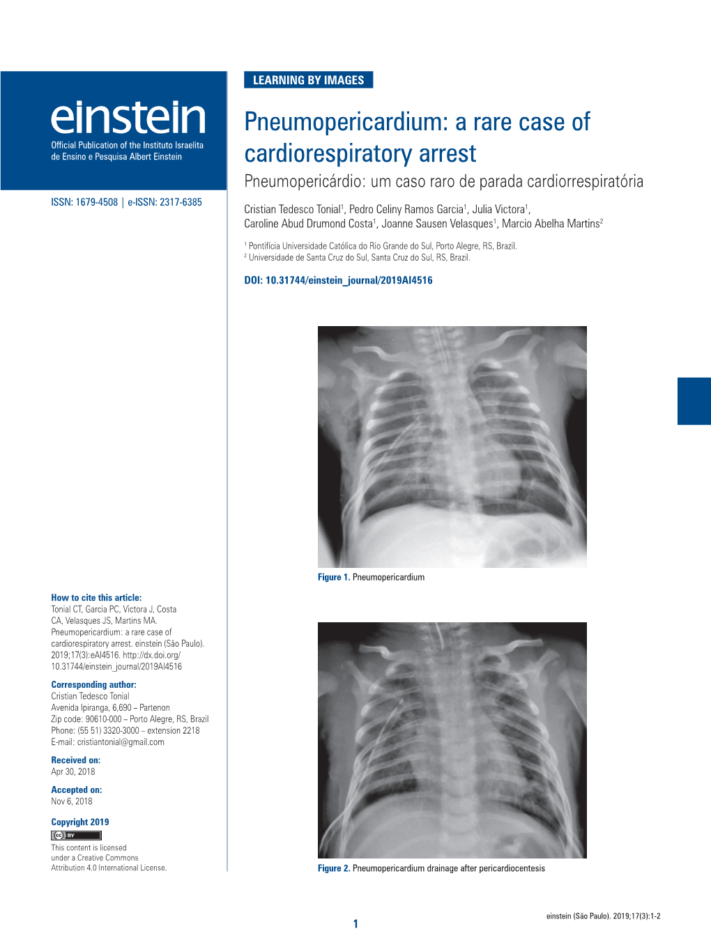 Pneumopericardium: a Rare Case of Cardiorespiratory Arrest